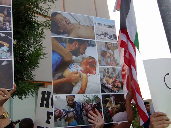 Pictures of wounded children displayed at anti-Israel (not 'pro-Gaza') rally in Fresno, 8/8/2014